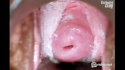 Сулуу аялдын гинекологиялык экспертизасы